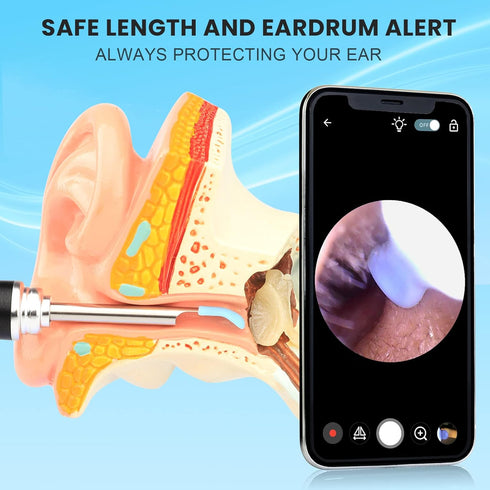 HD Visible Battery Powered Ear Wax Removal Kit, IP67 1080P Camera 6 LED Lights, Ear Irrigation Flushing System with Basin, WIFI Connection Mobile ...