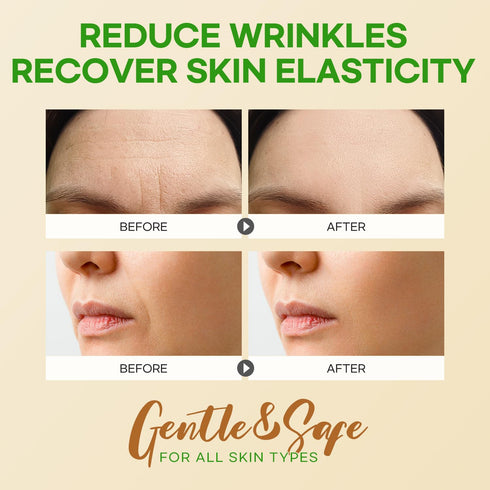 Forehead Wrinkle Patches 12Pcs with Smile Line Patches 24Pcs with Aloe, Collagen, Vitamin E, Forehead Wrinkles Treatment and Smile Lines Treatment...