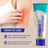 Tinea Versicolor Treatment Antifungal Cream: Extra Strength Natural Anti Fungal Anti Itch - for Tinea Versicolor Ringworm Athlete's Foot Jock Itch...
