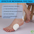 18 PCS Metatarsal Foot Pads for Pain Relief - 1/4” Thick Felt Foot Pads for Women & Men, Ball of Foot Cushions, Metatarsalgia Mortons Neuroma, For...