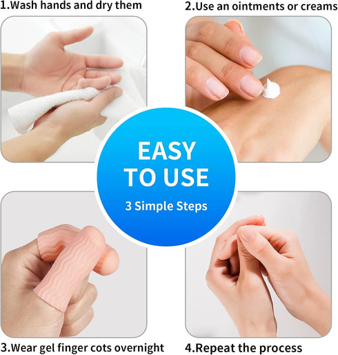 tifanso 12 PCS Finger Cots - Finger Protectors Gel Finger Gloves Covers Fingertip Sleeves Guards for Cracked Skin, Trigger Finger and More, Large ...
