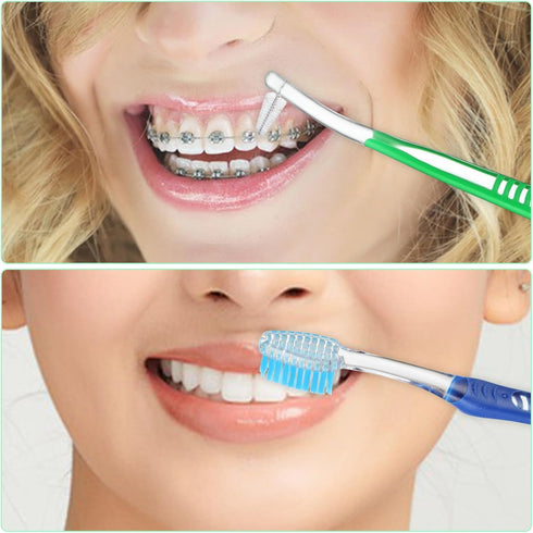 4 Pack Braces Brushes for Teeth with Interproximal Head, Orthodontic Toothbrush for Braces, Double Ended Soft Bristles for Ortho Brace Teeth Clean...