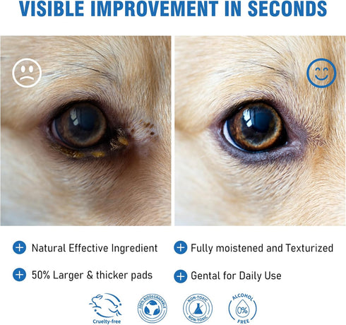 Dog Eye Wipes, Tear Stain Remover for Dogs, Big & Thick Cat Eye Wipes for Dogs, Mild Ingredient,Texturized & Presoaked Pet Eye Cleaner Pad for Dis...