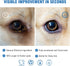 Dog Eye Wipes, Tear Stain Remover for Dogs, Big & Thick Cat Eye Wipes for Dogs, Mild Ingredient,Texturized & Presoaked Pet Eye Cleaner Pad for Dis...