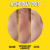Peace Out Skincare Acne Day & Night Duo. 6-hour Fast Acting Sheer Hydrocolloid Pimple Patches and Overnight Acne Dots with Salicylic Acid, Sticker...