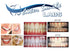 5 XL 38% Teeth Whitening Gel Dentist Recommended High Intensity Carbamide Peroxide Pro Dental Lab Direct, Sensitivity Free, Sold by Dentists, Whit...