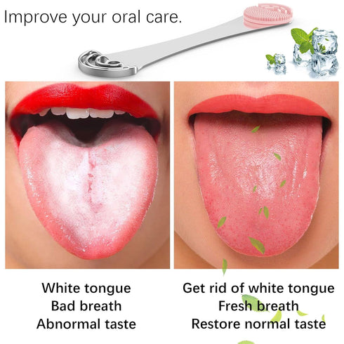 Tongue Scraper Cleaner, Bad Breath Treament&Get Rid of White Tongue, 100% BPA Free Medical Grade Stainless Steel Tongue Scrubber for Oral Care Den...