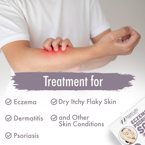Eczema Soap Bar for Face and Body – All Natural Dermatitis, Psoriasis Treatment for Dry Itchy Flaky Skin Relief – Gentle Detoxifying, Healing, Ant...