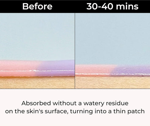 Dream Glow Under Eye Patches | Anti-Aging Eye Treatment Gel Masks With Vegan Collagen & Bakuchiol | Under Eye Masks For Dark Circles and Puffiness...