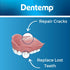 Dentemp Repair Kit - Repair-It Advanced Formula Denture Repair Kit (Pack of 3) - Denture Repair Kit Repairs Broken Dentures - Denture Repair to Me...