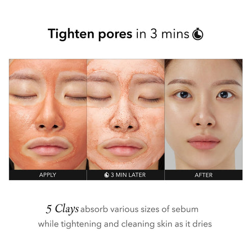 Aprilskin Carrotene IPMP 3-Min Quick Dry Pore Tightening Clay Mask | Kaolin & Zinc PCA | Reduces Pores & Sebum | Cooling Effect | Vegan | Gentle E...