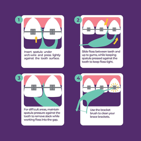 Platypus Orthodontic Flossers for Braces | Ortho Picks for Adults & Kids | Fits Under Arch Wire | Non-Damaging | Encourage Flossing Habits | Floss...