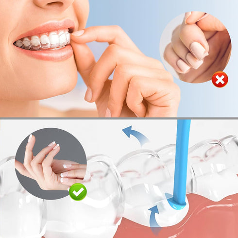 Aligner Removal Tool, 20 Invisible Braces Removal Tools, Retainer Remover Tool, Suitable for Removing Braces, Trays, Retainers, Dentures and Align...