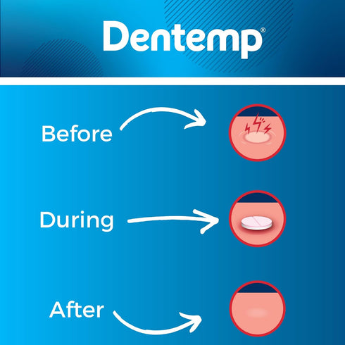 Dentemp Canker sore medicine 2pk Canker Cover - Oral Pain Reliever (12 Count) - Treatment to Relieve Canker Pain, Mouth Sores & Mouth Irritation -...