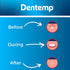 Dentemp Canker sore medicine 2pk Canker Cover - Oral Pain Reliever (12 Count) - Treatment to Relieve Canker Pain, Mouth Sores & Mouth Irritation -...