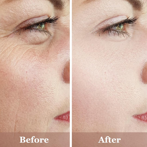 Anti Againg Face Serum Trio, 20% Vitamin C, Powerhosue Hyaluronic-Acid and 2.5% Retinol Serum For Face - 3 Bottles x 1 Fl Oz | Brightening, Firmin...