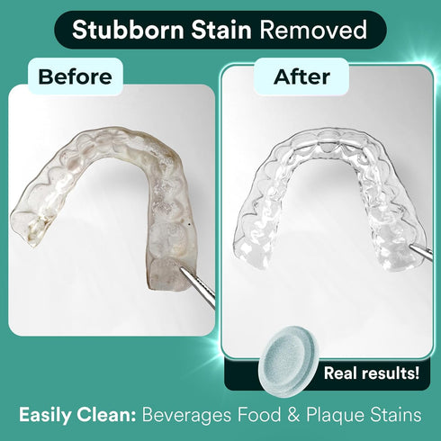 Retainer Cleaner Tablets, Invisalign Cleaner, Remove Stains, Odors & Plaque, Night Guard Cleaner, FSA & HSA Eligible, 4-Month Supply of PERSULFATE...