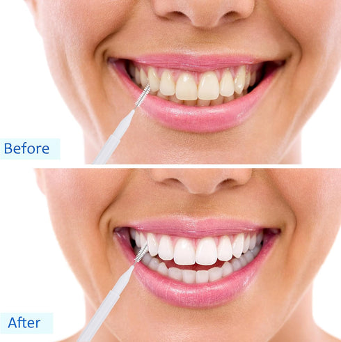 Patelai 100 Pieces Braces Brush for Cleaner Interdental Brush Toothpick Dental Tooth Flossing Head Oral Dental Hygiene Flosser Toothpick Cleaners ...