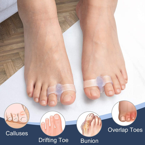 Gel Toe Corrector, 10 Pack of Toe Separators with 2 Loops, Big Toe Spacer for Bunion Pain and Overlapping Toe (FSA or HSA Eligible)...
