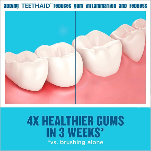 | Teeth Whitening Toothpaste & Whitening Mouthwash | Teeth Whitener Travel Toothpaste, Kids Toothpaste & Fluoride Free Toothpaste For Adults | Too...