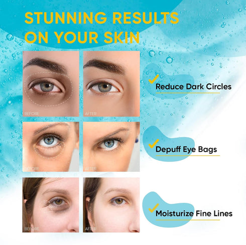 Anti-Aging Under Eye Patches for Wrinkles: 30 Pairs Retinol Collagen Gel Eye Pads - Reduces Dark Circles, Eye Bags & Puffiness, Fine Lines Smoothi...