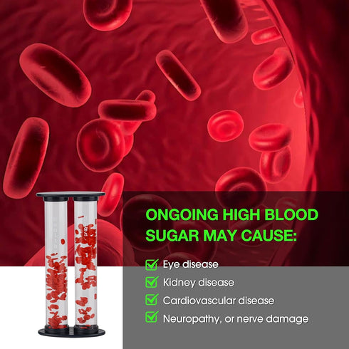High Blood Glucose & Healthy Blood Glucose Vessel Compare Models for Medical Doctor Teaching Diabetes Mellitus DM Patient...