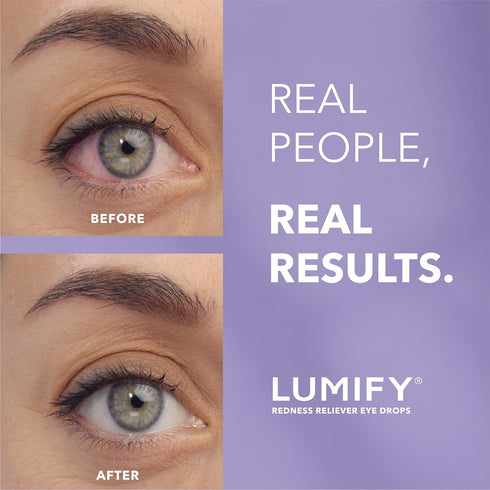 LUMIFY Redness Reliever Eye Drops 0.08 Ounce (2.5mL)...