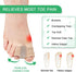 Gel Toe Separators with 2 Loops, Bunion Corrector for Women and Men 1 Pair, Toe Straighteners for Toe Overlapping and Crooked, Toe Spreader for Bu...