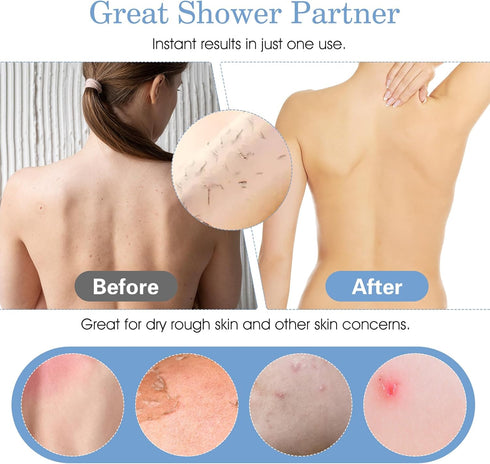 Double-Sided Back Scrub, 37.4 Inch Exfoliating Back Scrubber with Handles Washcloth for Shower Blue Exfoliator Body Scrub Towel Exfoliator Bath To...