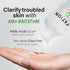 NOSCA9 Trouble Clear Toner S | Hydrating Toner for Face w/Centella Asiatica, LHA & PHA | Gentle & Exfoliating Toner for Sensitive Skin | Korean Sk...