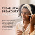 Bolden Overnight Spot Treatment | Targets and Gets Rid of Breakouts Overnight | For All Skin Types with Active Blemishes & Prevents Future Breakou...