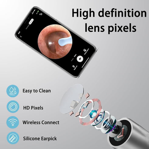 Ear Wax Removal with Camera - High-Definition Ear Health Monitor for iPhone, iPad & Android Phones...