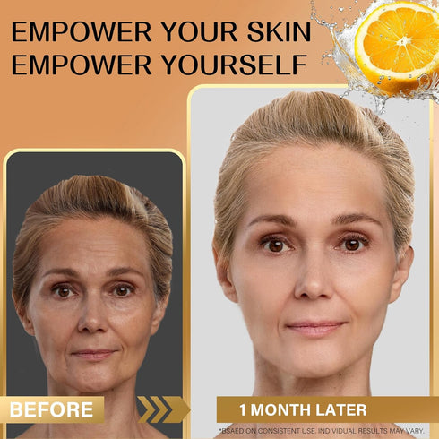 Super Vitamin C Serum with Hyaluronic Acid: Vitamin C Serum for Mature Skin...