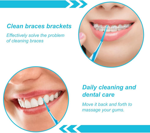 Portable Soft Silicone Interdental Brush Alignment Brush Corrective Interdental Brush Adaptive Interdental Brush for Cleaning Teeth Healthy Dispos...