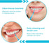 Portable Soft Silicone Interdental Brush Alignment Brush Corrective Interdental Brush Adaptive Interdental Brush for Cleaning Teeth Healthy Dispos...
