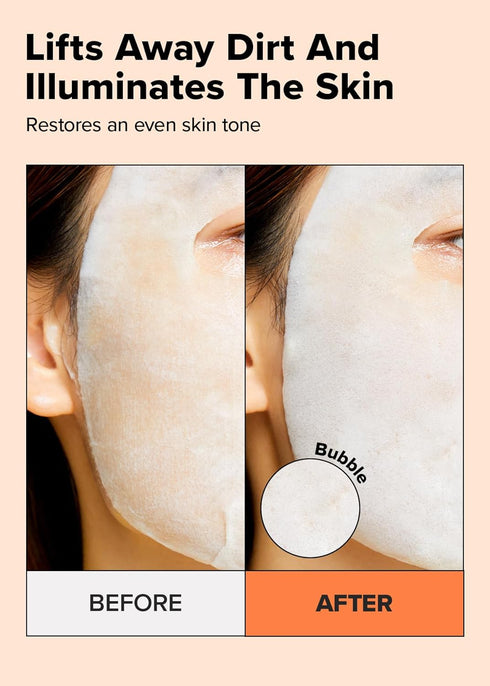I DEW CARE Sheet Mask Pack - Glow Up Bubbles | Bubble Facial Mask, with Vitamin and Niacinamide, Daily Skin Care, Brightening, Illuminating, Detox...