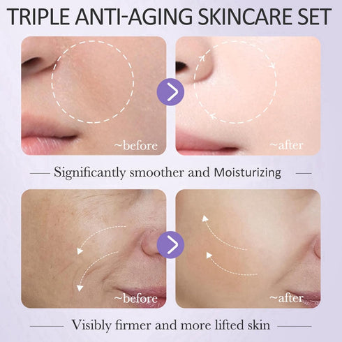 3-In-1 Hydrating Skincare Set With Vitamin-C, Retinol And Hyaluronic-Acid, Skincare Gift Set For Women, Anti-Aging Skin Care Set With Hyaluronic-A...