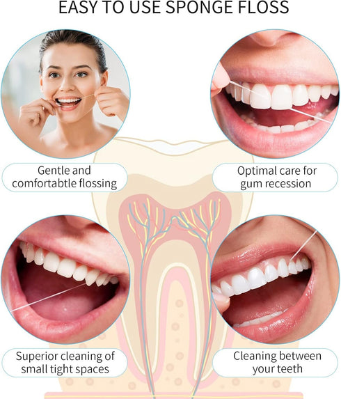 Easy-to-Use Sponge Floss for Cleaning of Implants Bridges with Stiff Plastic Ends and Sponge Floss Oral Hygiene (2)...
