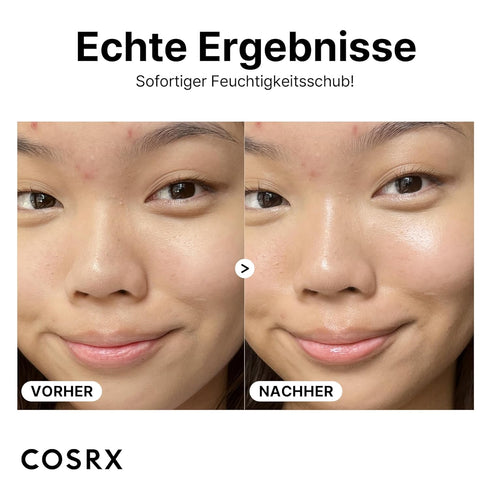 COSRX Pure Sodium Hyaluronic Acid 3% Serum, Hydration & Moisture Boosting Facial Serum for Fine Lines & Wrinkles, Plump & Repair Dry Skin, 0.67fl....