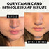 Eclat Skincare Face Serum Set - Vitamin C Serum for Radiance, Retinol Serum for Wrinkles...