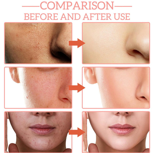 30% Vitamin C Face Serum, Niacinamide and Hyaluronic Acid Serum, 5 in 1 Vitamin E Serum for Face Anti Aging, Hydrating Collagen Face Serum for Wom...