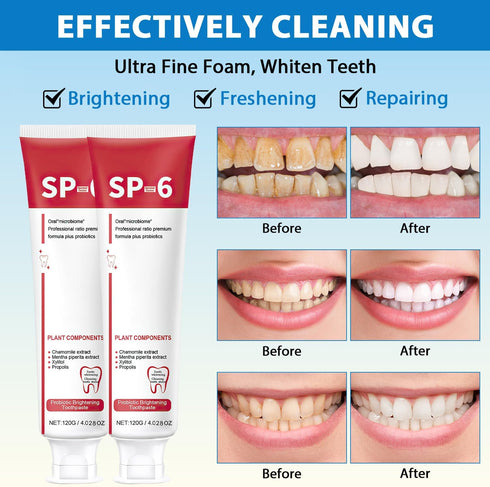 2PCS Sp-6 Ultra Whitening, Sp-6 Probiotic Whitening Toothpaste, Ultra Whitening Toothpaste sp6, Probiotic Brightening Toothpaste,Deep Cleaning Car...