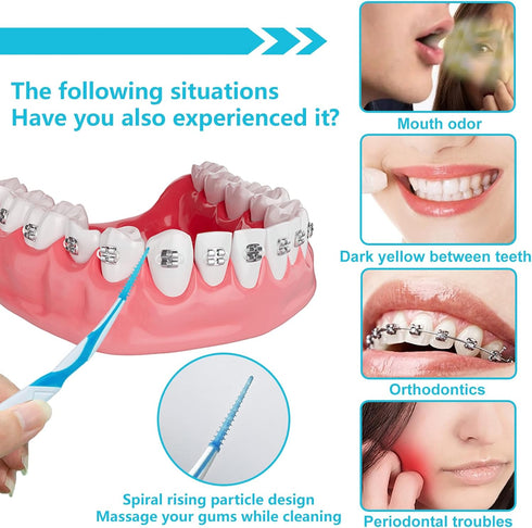 Portable Soft Silicone Interdental Brush Alignment Brush Corrective Interdental Brush Adaptive Interdental Brush for Cleaning Teeth Healthy Dispos...