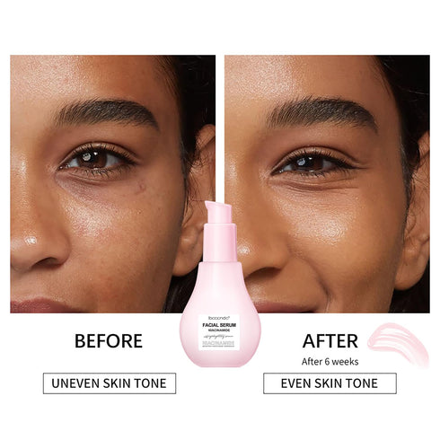 60ML Watermelon Extracts Niacinamide Serum,Watermelon Hydrating Serum With Hyaluronic Acid,Moisturizing, Brighten,Lightweight Watermelon Toner, 2....