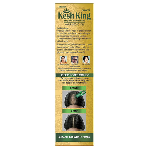 Ayurvedic Hair Oil | Herbal Oil with Bhringraj & Amla | Enhance Hair Growth | Reduce Hairfall | Nourishes Scalp | Provides Long & Thick Hair | 10....
