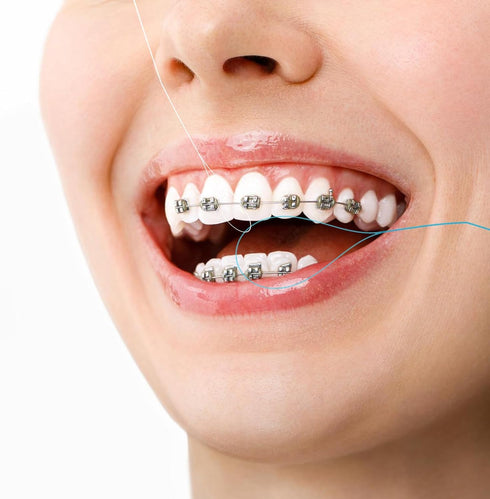 Dental Floss Threaders, 100PCS Dental Floss Deep Clean Dental Threader Interdental Floss for Braces Bridges Implants Oral Health Care 2Pack(Green)...