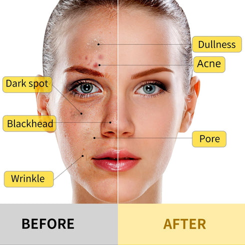 Turmeric Vitamin C Clay Mask, Deep Cleansing Facial Mask, Clay Face Mask Skin Care with Kaolin Clay and Aloe for Pores, Acne, Dark Spots, Hydratin...