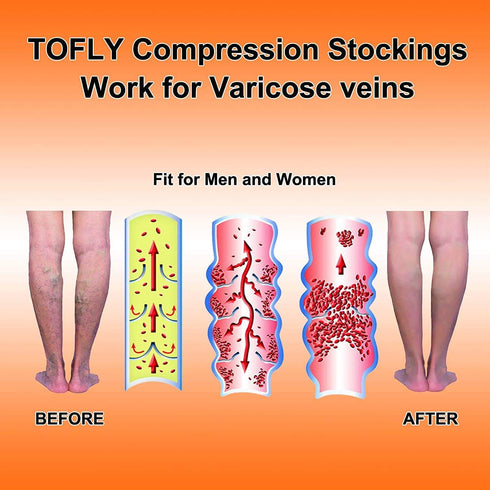 TOFLY® Calf Compression Sleeve for Men & Women, 1 Pair, Footless Compression Socks 20-30mmHg for Leg Support, Shin Splint, Pain Relief, Swelling, ...