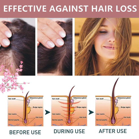 Bello Hair Helper Spray, 2024 New Rice Nutri Spray, Hair Nursing Spray, Hair Mask, Repair Hair Damage Improve Frizz Hair, Help to Stop Thinning an...