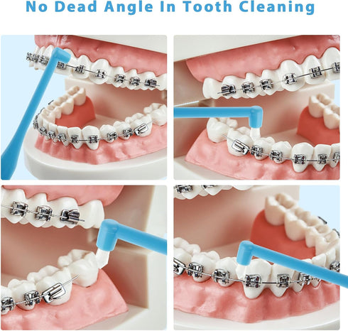 Single End Tufted Toothbrush, 5 Pcs Interspace Tooth Brush Tapered Trim Tooth Cleaner Interdental Toothbrush Tuft Gap Toothbrush for Orthodontic D...